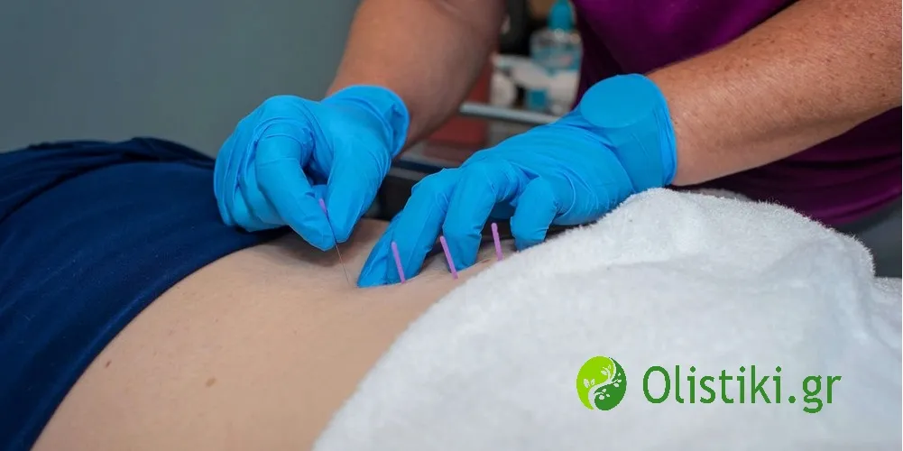Πέντε πράγματα που πρέπει να γνωρίζετε για την Ξηρά Βελόνα (dry needling)